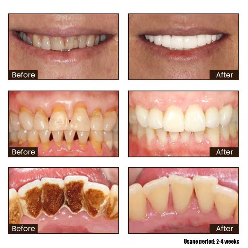 Niacinamide Whitening Toothpaste